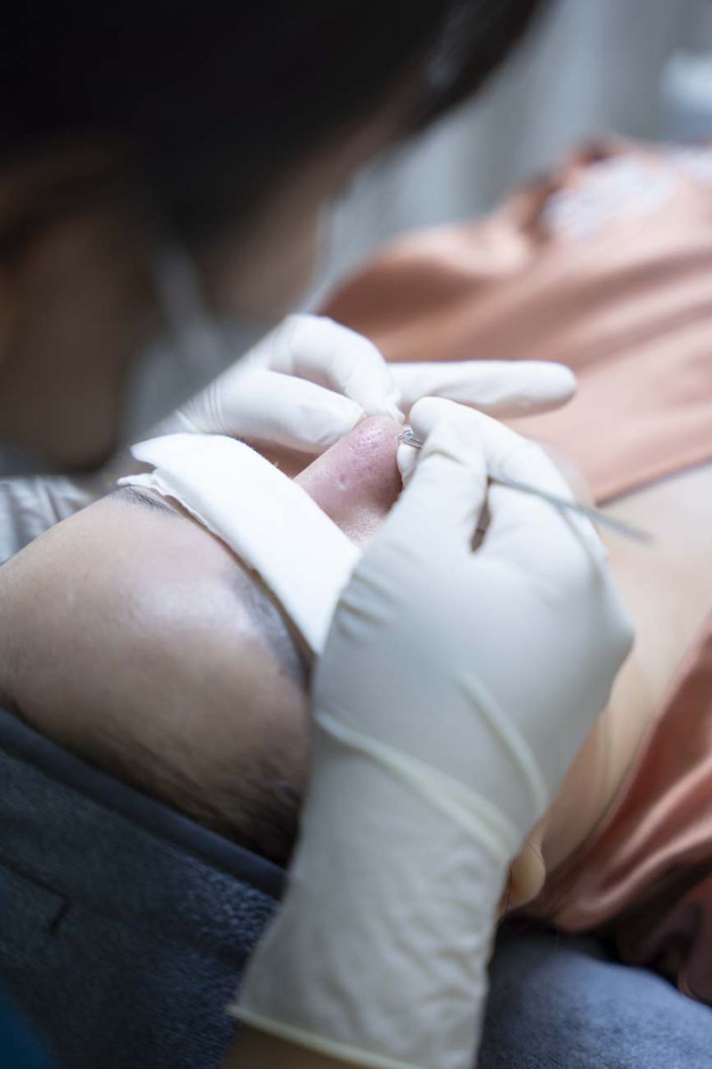 Spa nặn mụn Bình Tân